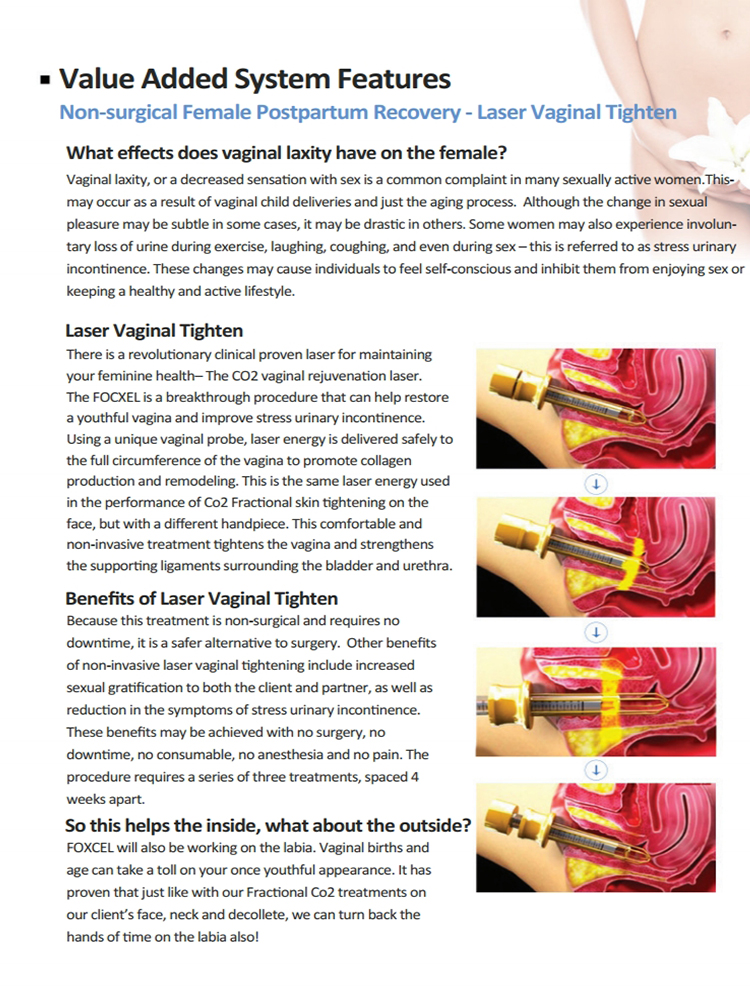 HOT Dermatology Aesthetic vaginal tigthening fractional co2 laser equipment