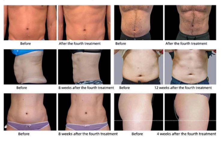 852b4aa44e200ef5e2ee51a530372a5